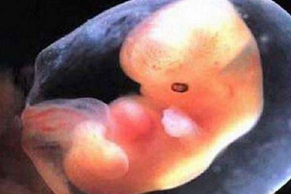 怀孕2个月有胎芽没胎心有希望吗
