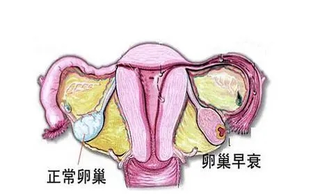 卵巢早衰备孕这么做！(图1)