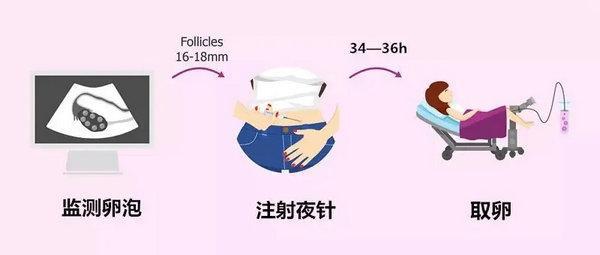 试管婴儿促排卵时、取卵时、移植后需要注意哪些？(图1)