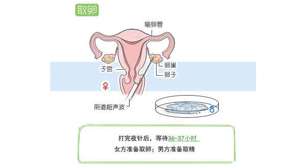试管婴儿的流程(图8)