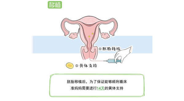 试管婴儿的流程(图9)