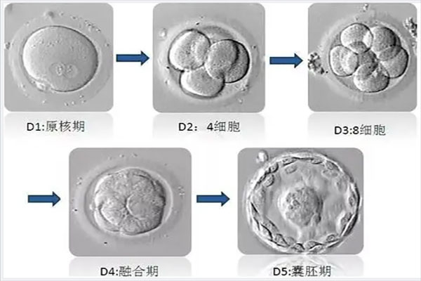 鲜胚、囊胚、冻胚移植哪个成功率高