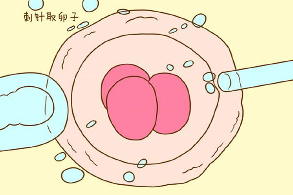 针刺取卵子