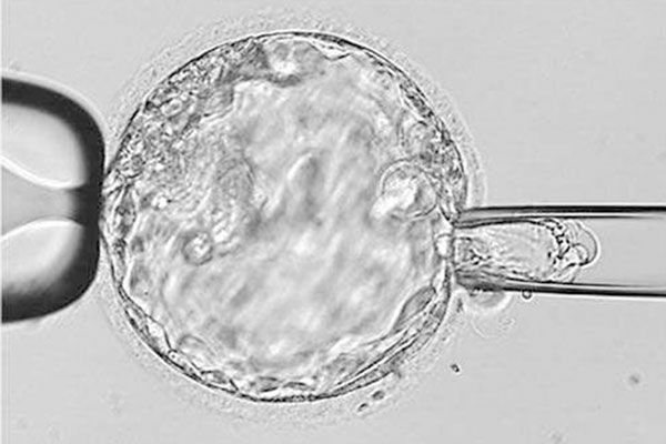 取卵后胚胎移植的4大条件一览