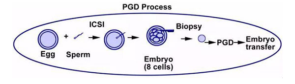 PGD植入前基因诊断