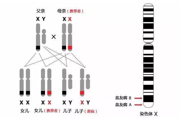 血友病如何遗传