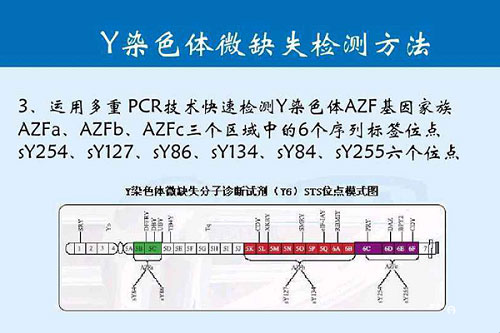 Y染色体微缺失检查