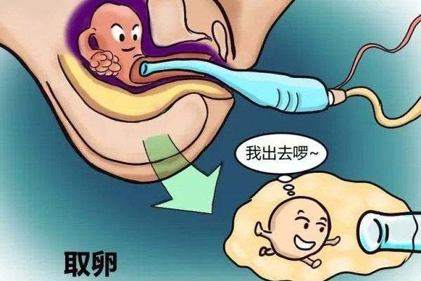 取卵手术痛不痛