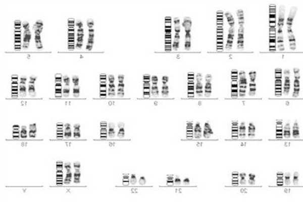 人类染色体g显带