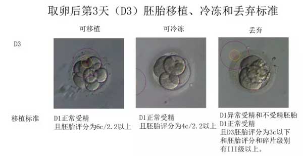 取卵后第3天丢弃胚胎的标准