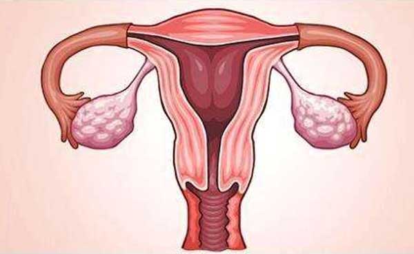 卵巢发育不全能做泰国试管婴儿吗？