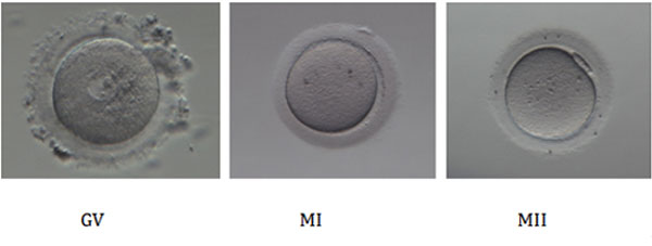 卵子发育过程中的三个阶段