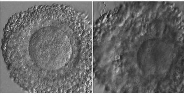 显微镜下卵子发育的颗粒细胞团