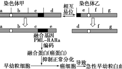 急性早幼粒细胞白血病什么原因导致的?染色体异