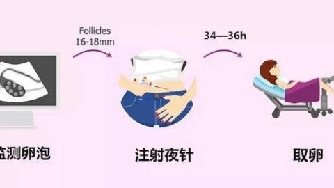 试管婴儿促排卵时、取卵时、移植后需要注意哪些？