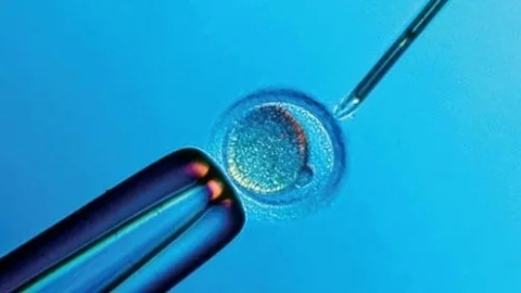 试管受精前,双方应该做哪些检查项目?