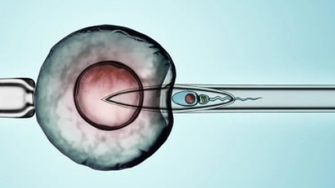 试管婴儿体外受精胚胎移植