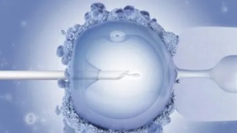 第一次去医院做试管受精不知道该准备什么？