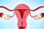 输卵管堵塞做试管婴儿的话可以怀孕吗？